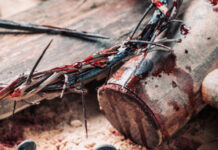 Redenção na Dor: Desvendando as Lições Poderosas de Lucas 23:33-38